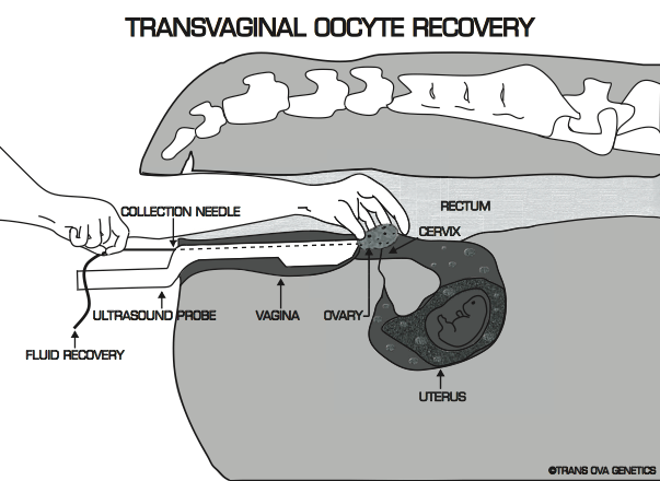 Figure 1. Follicular aspiration of oocytes